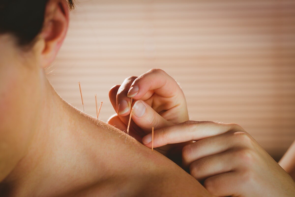 Reducing a patient's neck pain with acupuncture